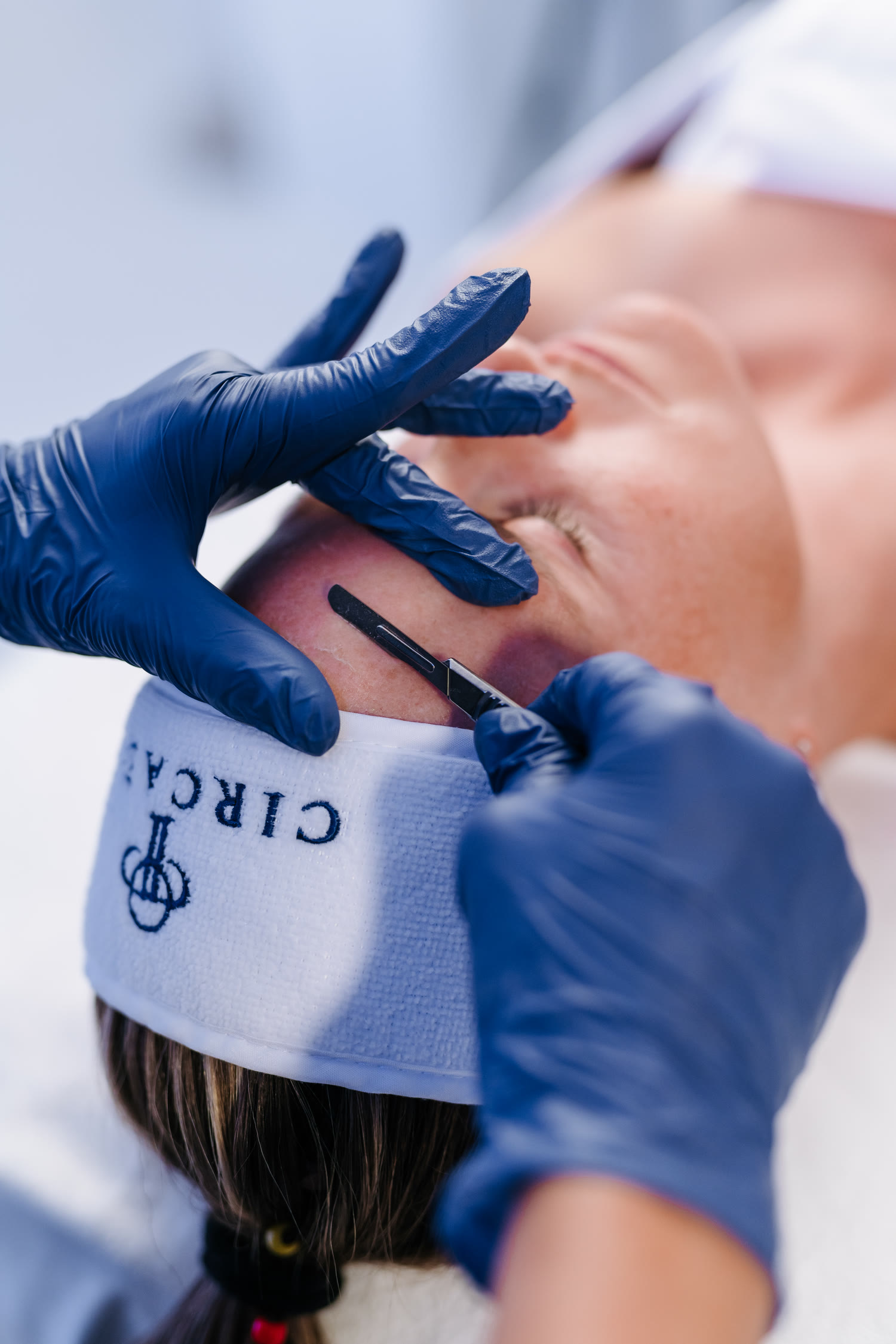 Dermaplaning Behandlung